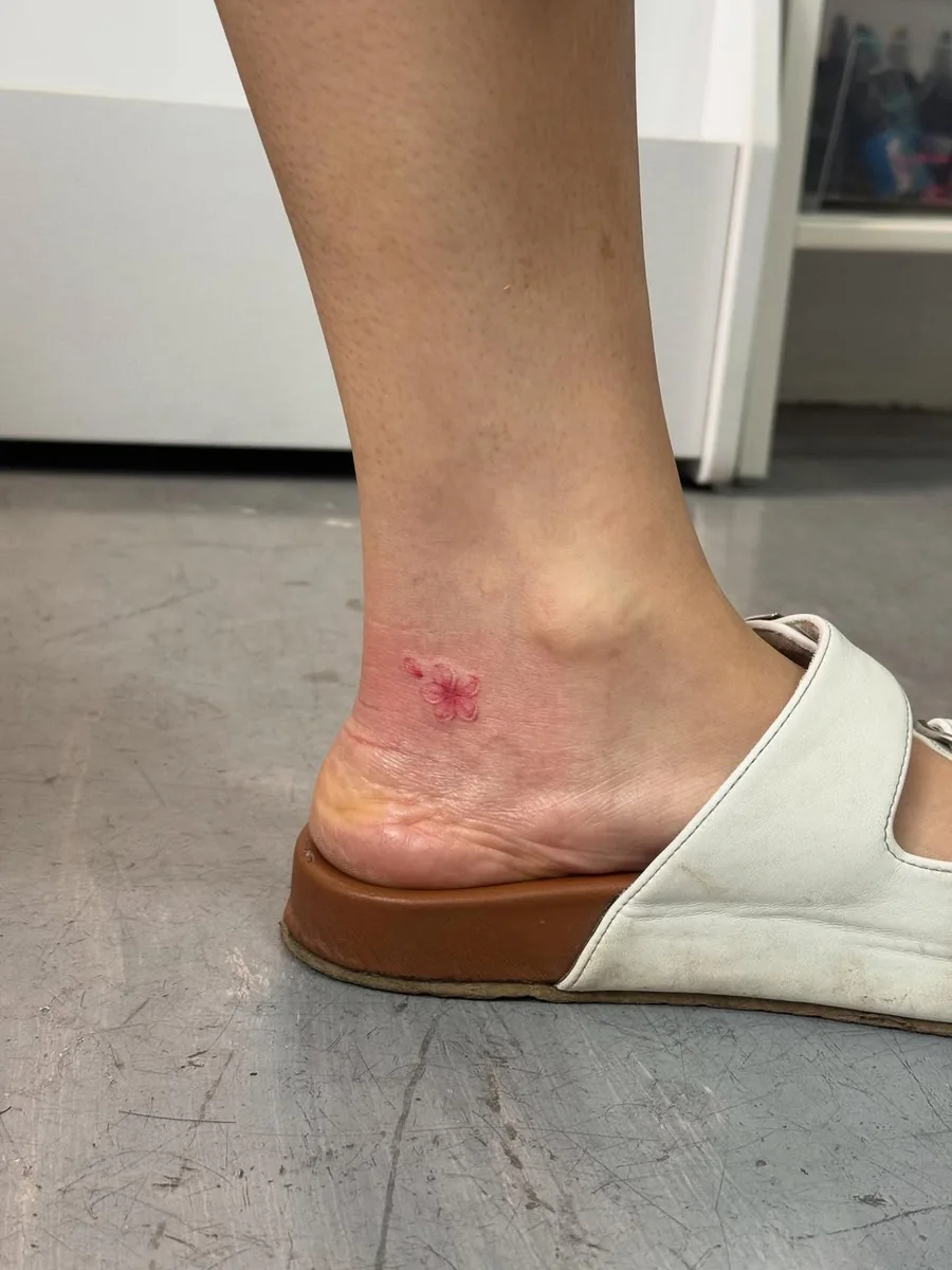 Full view of the ankle showing the true size of the tiny piece